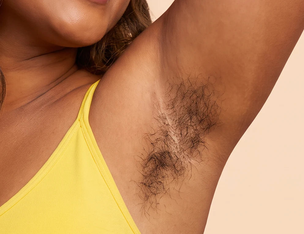 Before-style Underarm appearance visual supplied on the reference product page