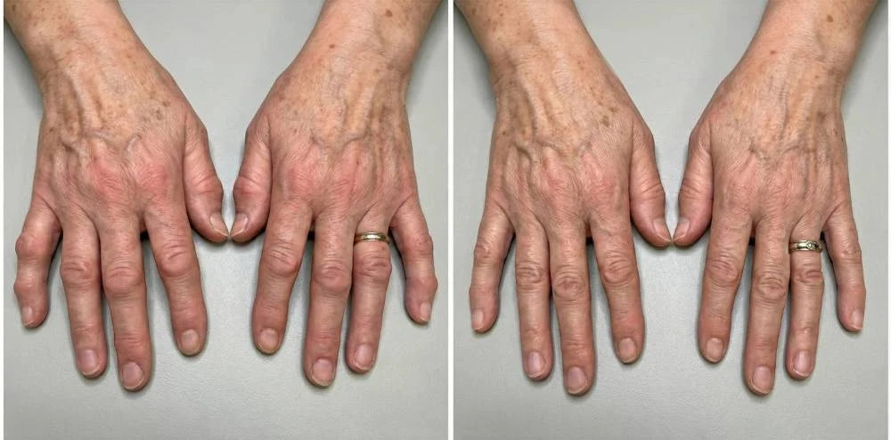 Supplied side-by-side hand-area appearance reference; not a verified product result