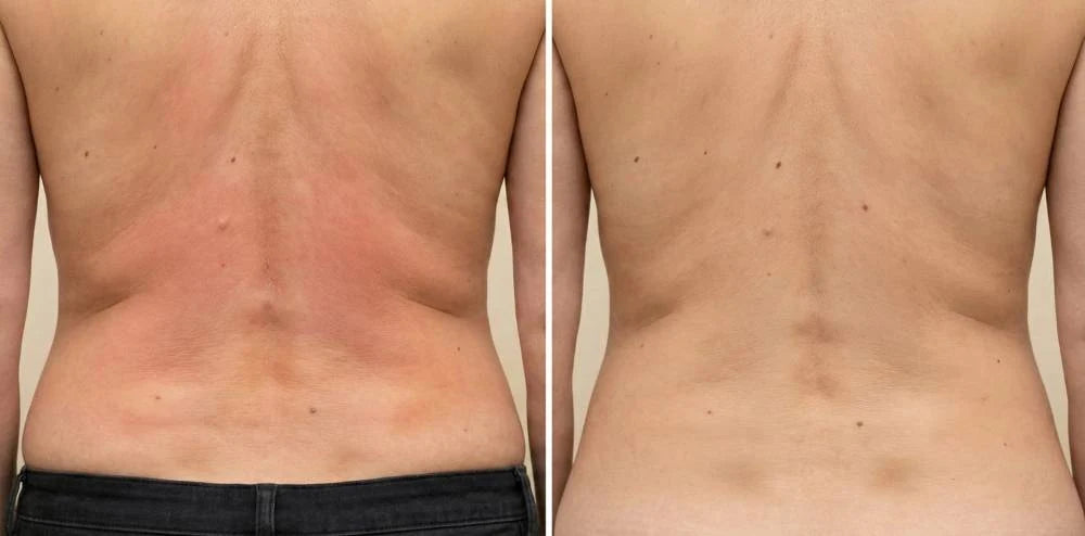 Supplied side-by-side back-area appearance reference; not a verified product result