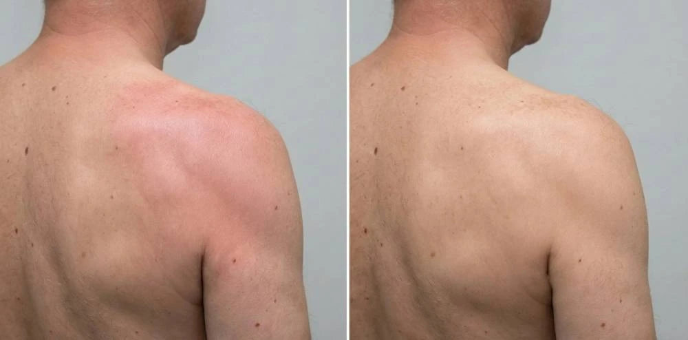 Supplied side-by-side shoulder-area feedback photo